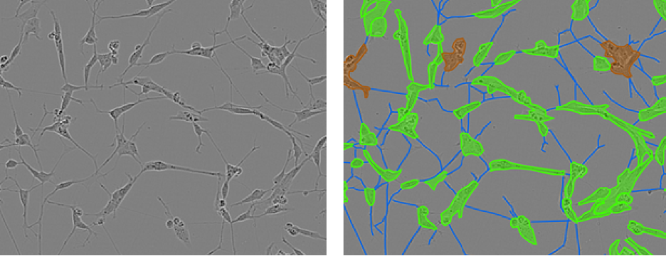 neuron segmentation